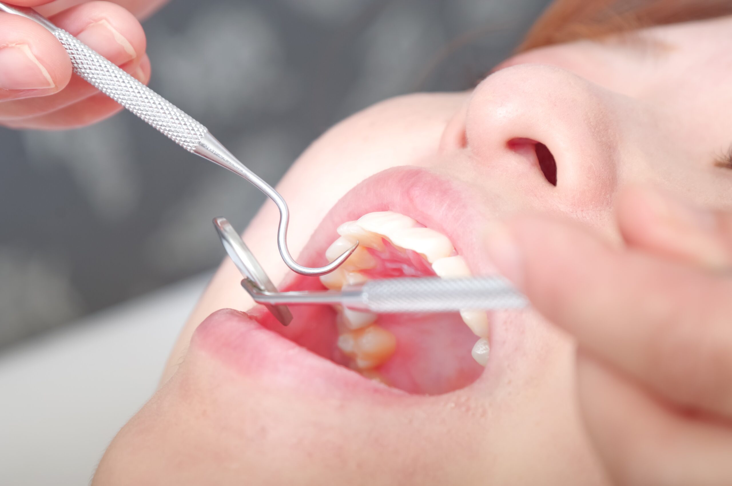 歯科治療中の女性